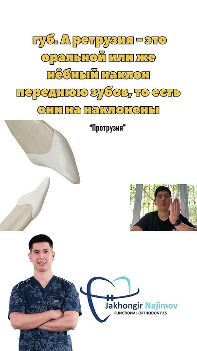 ПРОТРУЗИЯ и РЕТРУЗИЯ ЗУБОВ🧐 #orthodontist #tashkent #video #youtube # ...