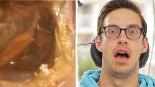 The Try Guys Get Earwax Extractions...