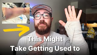 Skin Graft Surgery Update: Arm Looks Gnarly
#phalloplasty #arm #rff
I give an update on my graft revision I had with Dr. Lin on August 5th. I had my first post op appointment and saw my arm for the first time. I go through the emotional aspects of things and update on my recovery.
Coaching: www.codyharman.com
Instagram: mrcoachcody
Email: trainwithcoachcody@gmail.com Skin Graft Surgery Update: Arm Looks Gnarly