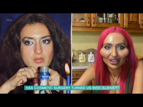 Покрещук анастасия до и после пластики