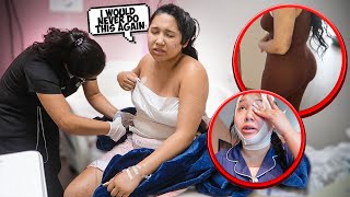 I GOT A BBL IN TIJUANA *RAW FOOTAGE* PT. 2 BODY REVEAL