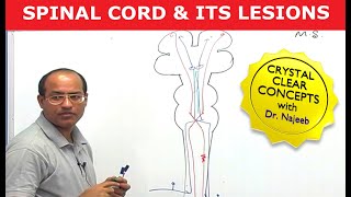 Spinal Cord Injury and its Lesions | Neuroanatomy