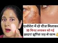 कितनी भी पुरानी झाइयां,झुरिया,कालापन खत्म करें 100%👌|| How to remove pigmentation