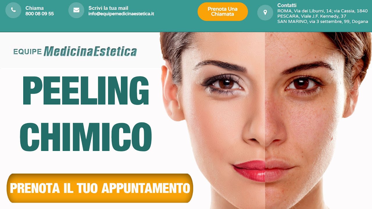 peeling chimico viso