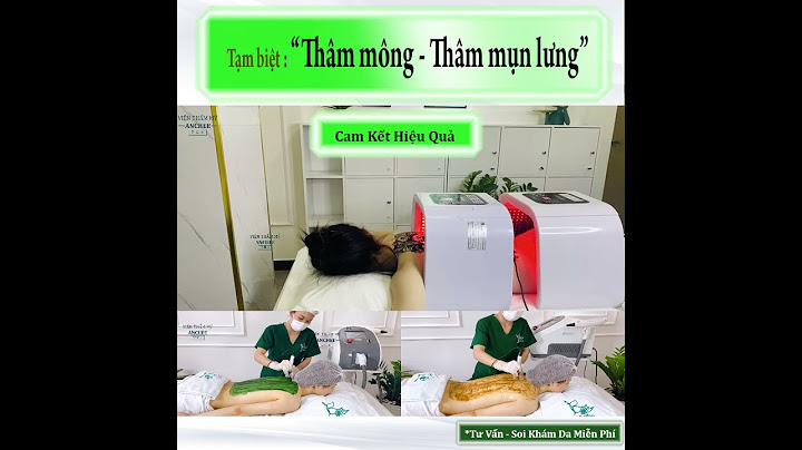 Giá nặn mụn ở v clinic spa là bao nhiêu năm 2024