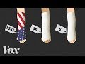 Why American health care is so expensive? - The real reason explained