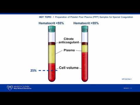 Platelet Poor Plasma Update [Hot Topic]