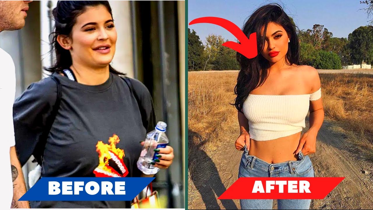 Kylie Jenner Before And After Weight Loss