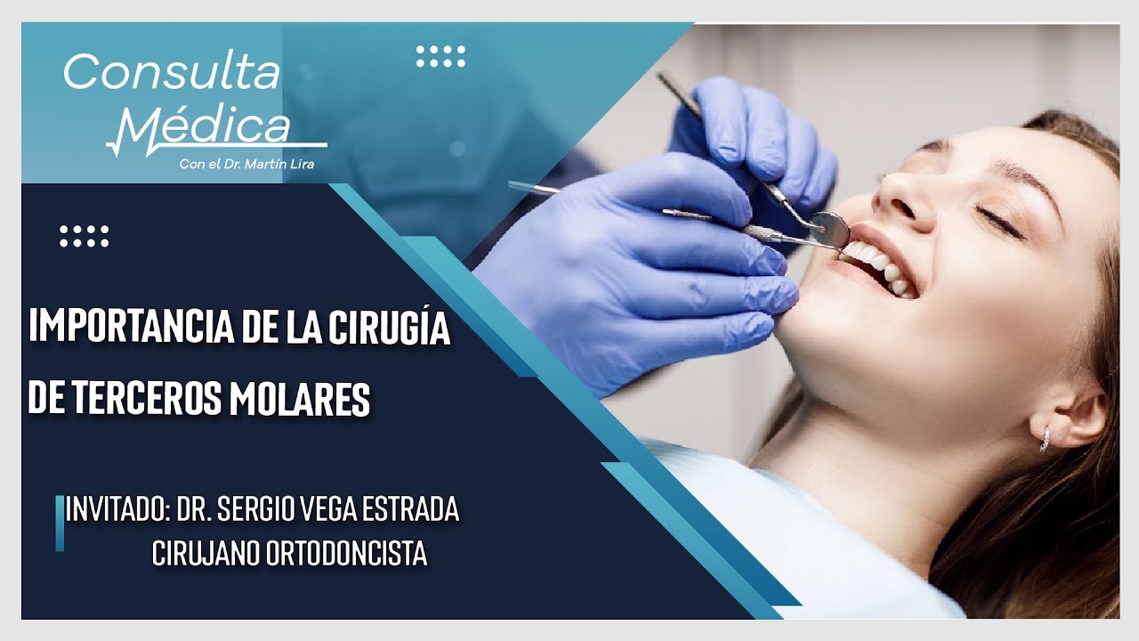 Importancia de la cirugía de terceros molares | Consulta Médica | SMRTV