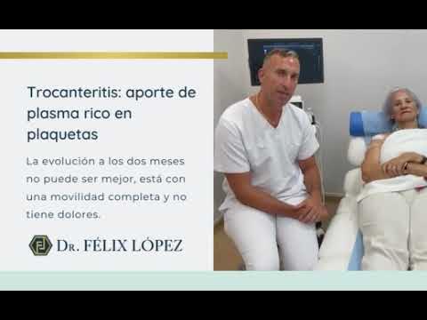 Solución para la artrosis de manos - Dr. Félix López - Traumatólogo en  Madrid