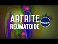 ARTRITE REUMATOIDE | SÉRIE SAÚDE BRASIL
