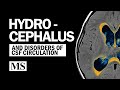 Hydrocephalus and the disorders of csf circulation