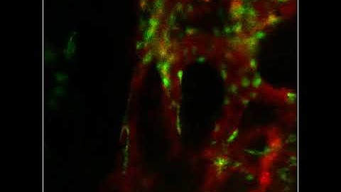 In vivo 2-photon skull imaging on mouse