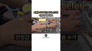 뇌졸중 손 엄지손가락 이렇게 해보세요
