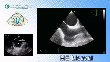 081 Basic View TEE KAMC