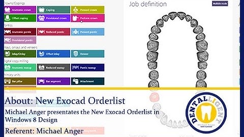 EXOCAD TUTORIAL - Dental-Teaser-The NEW Exocad Orderlist in Windows 8 Design