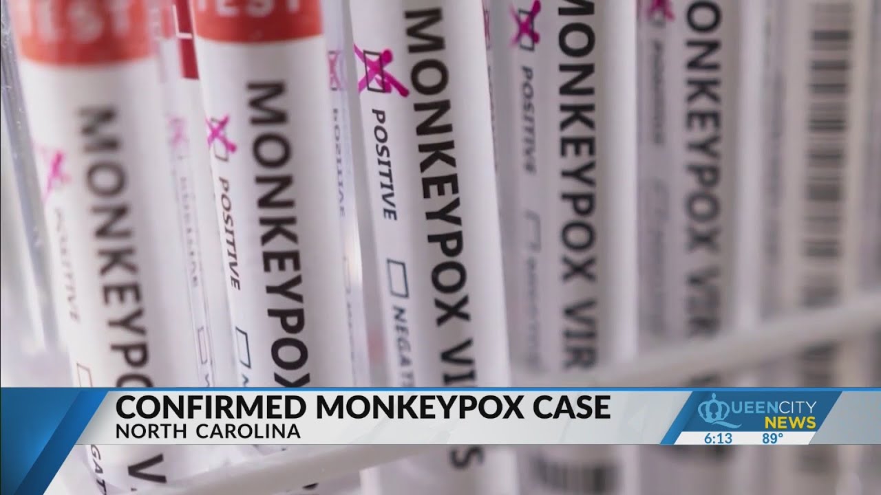 Confirmed monkeypox case in NC YouTube