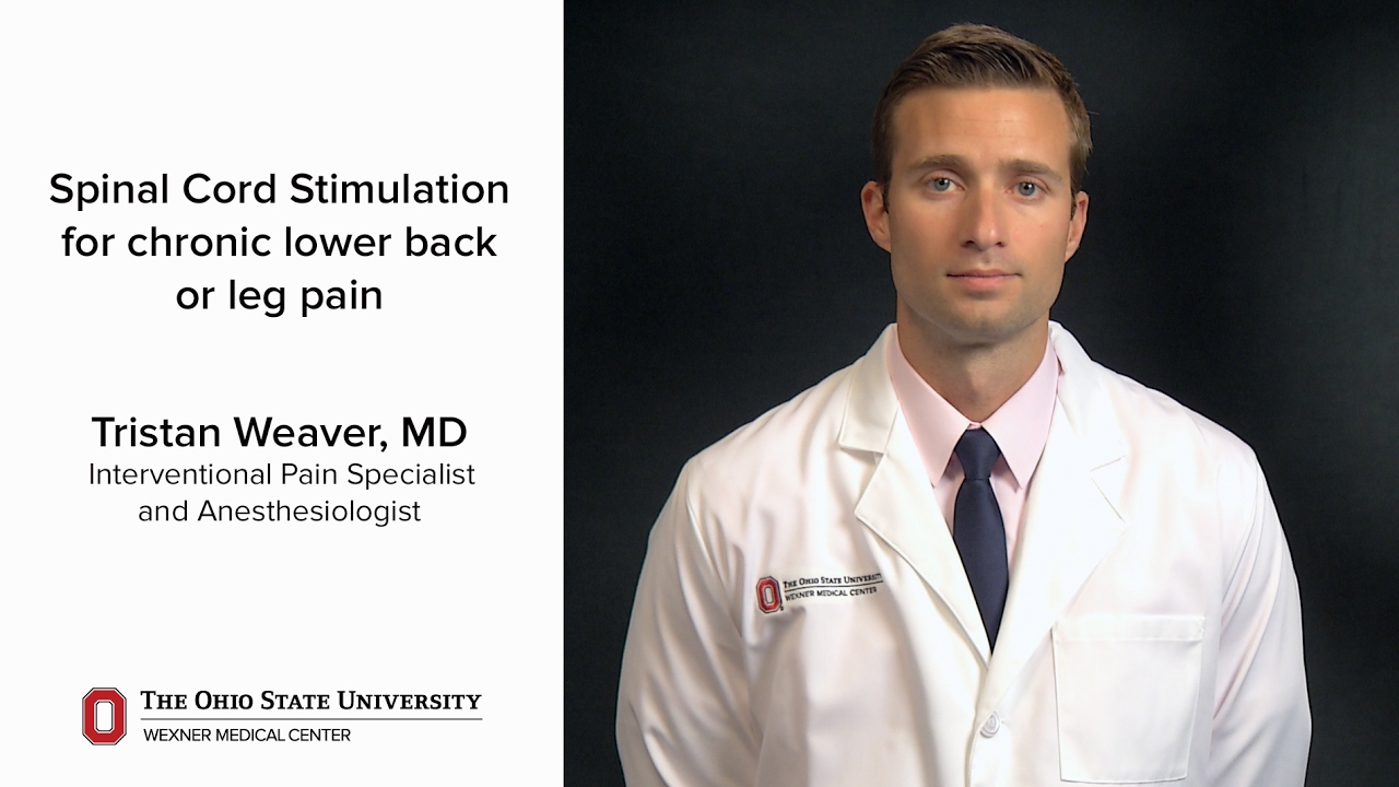 Spinal Cord Stimulation for Chronic Back Pain Video