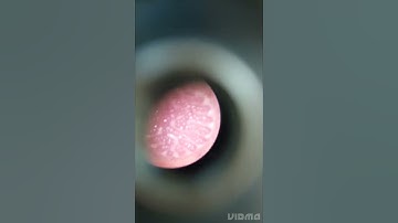 Pteridophyta# ( Lycopodium)#Botany practical # B.SC 2- semester #Short