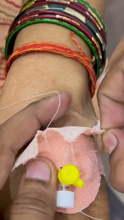 How to easily remove IV cannula | IV cannula removal