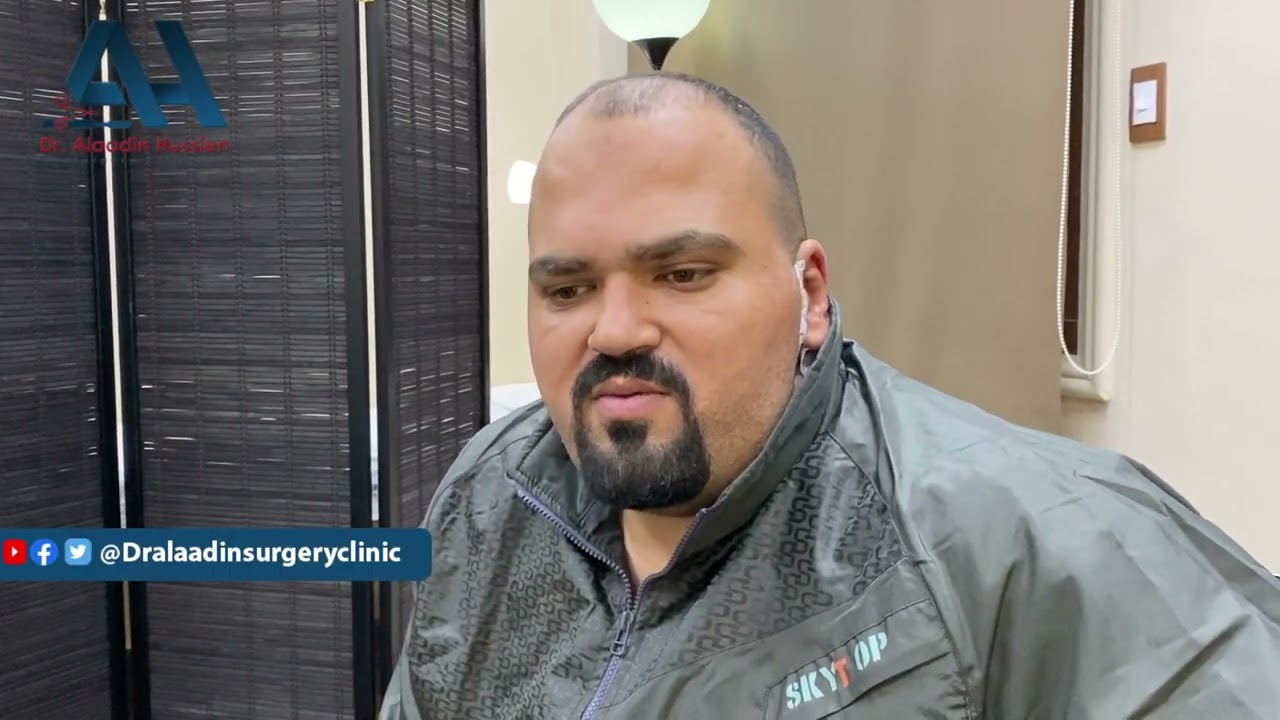 شهادة اخرى  لأحد مرضانا بعد جراحة استئصال  الغدة النكافية