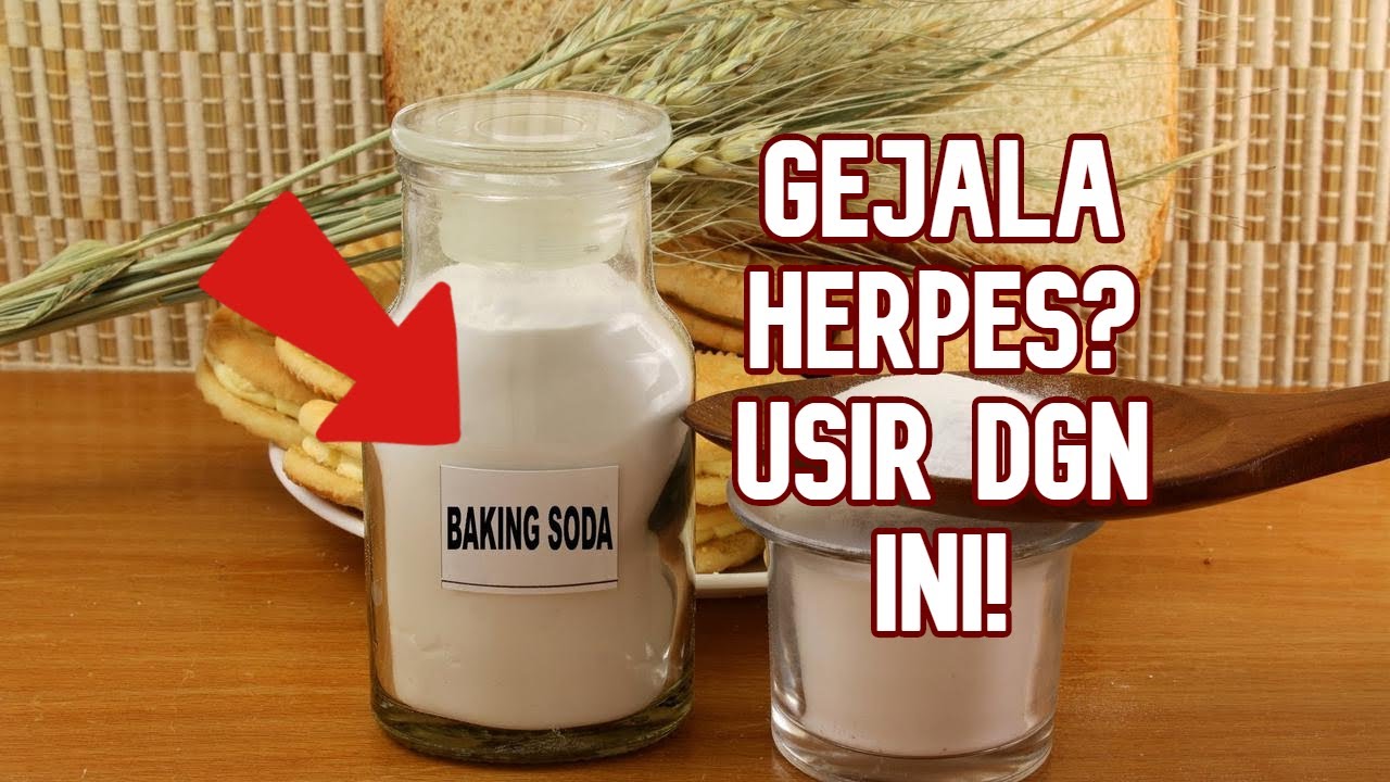 OBAT HERPES GENITAL ZOSTER SIMPLEK MENGGUNAKAN BAKING SODA MUJARAB