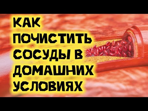 Как почистить сосуды в домашних условиях народными средствами