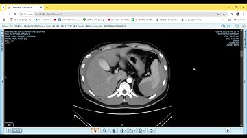 Carestream Vue Motion   Google Chrome 2025 04 06 23 44 24