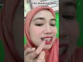 review behel 1,5 month
