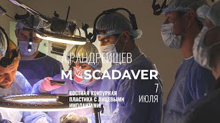 Костная контурная пластика с лицевыми имплантами