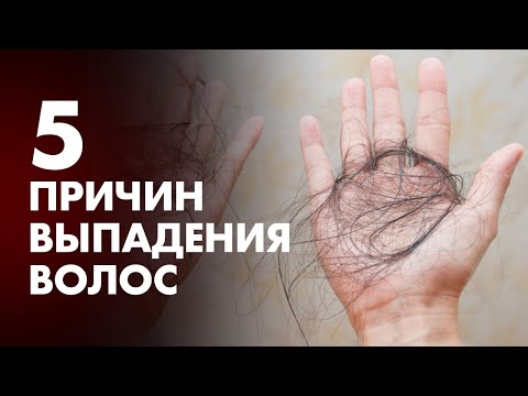 5 ПРИЧИН ВЫПАДЕНИЯ ВОЛОС | Клиника Online