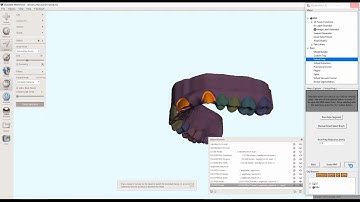 D3Lab x64  -  Provisional Crowns, Virtual Extractions and Virtual Crown Preps in Meshmixer