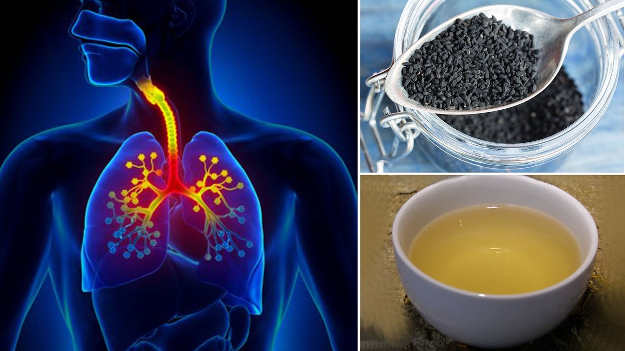 How to Get Rid of Asthma Treatment Naturally With Black