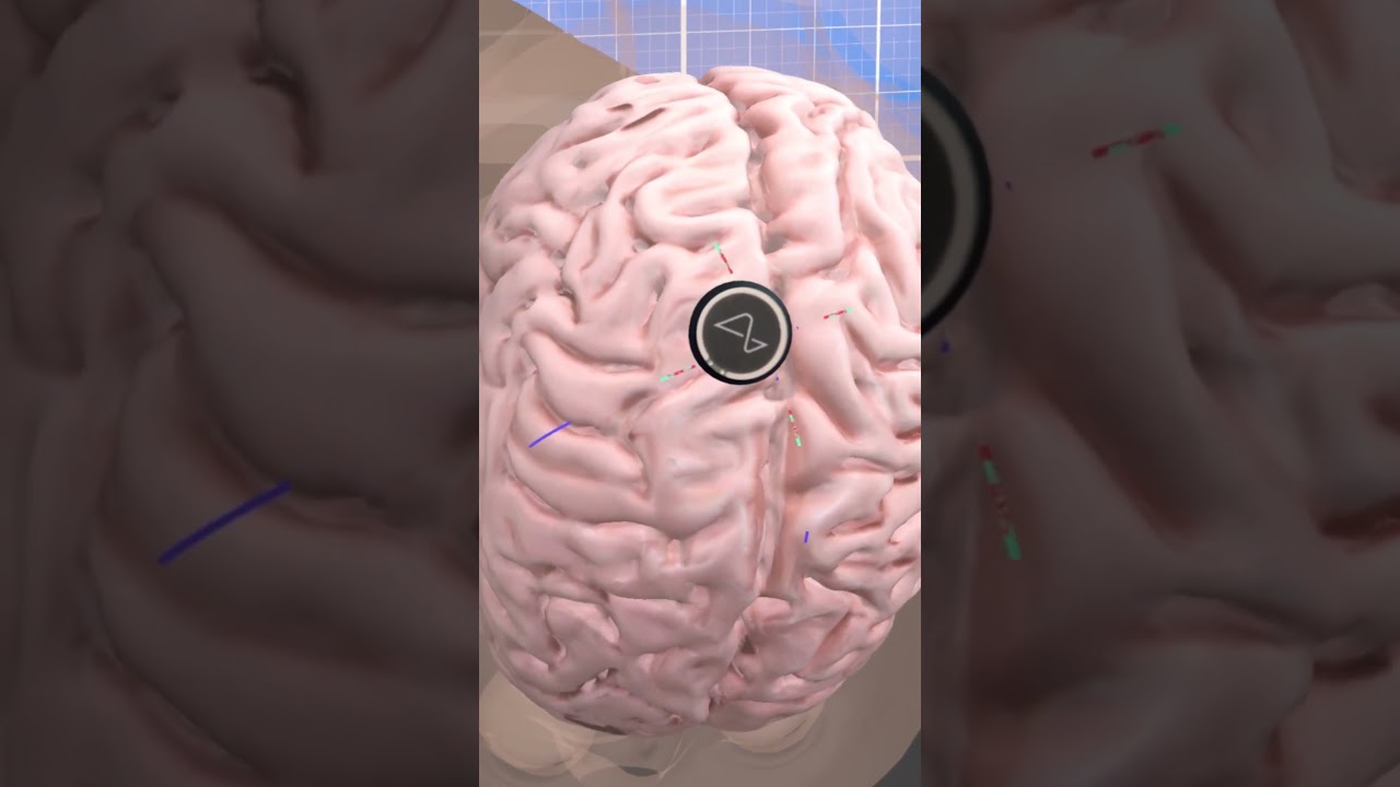 Neuralink: The Future of Brain Tech! 🧠 #shorts #trending #explore