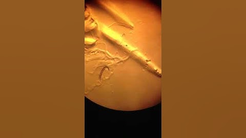 C. elegans uncoordinated mutant