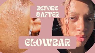 Glowbar Review + Following Skincare!