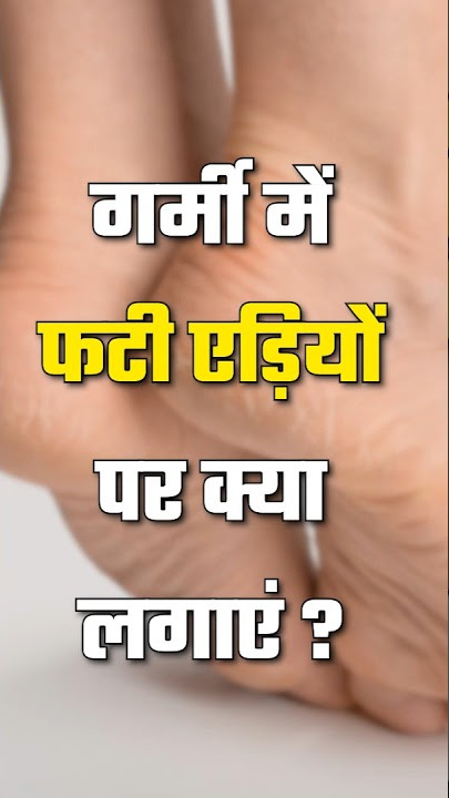 Garmi Mein Fati Ediyon Par Kya Lgaye #health #goodlife #healthtips #goodlife