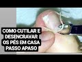 COMO CUTILAR OS PÉS E DESENCRAVAR PASSO A PASSO mais um TBT gostoso