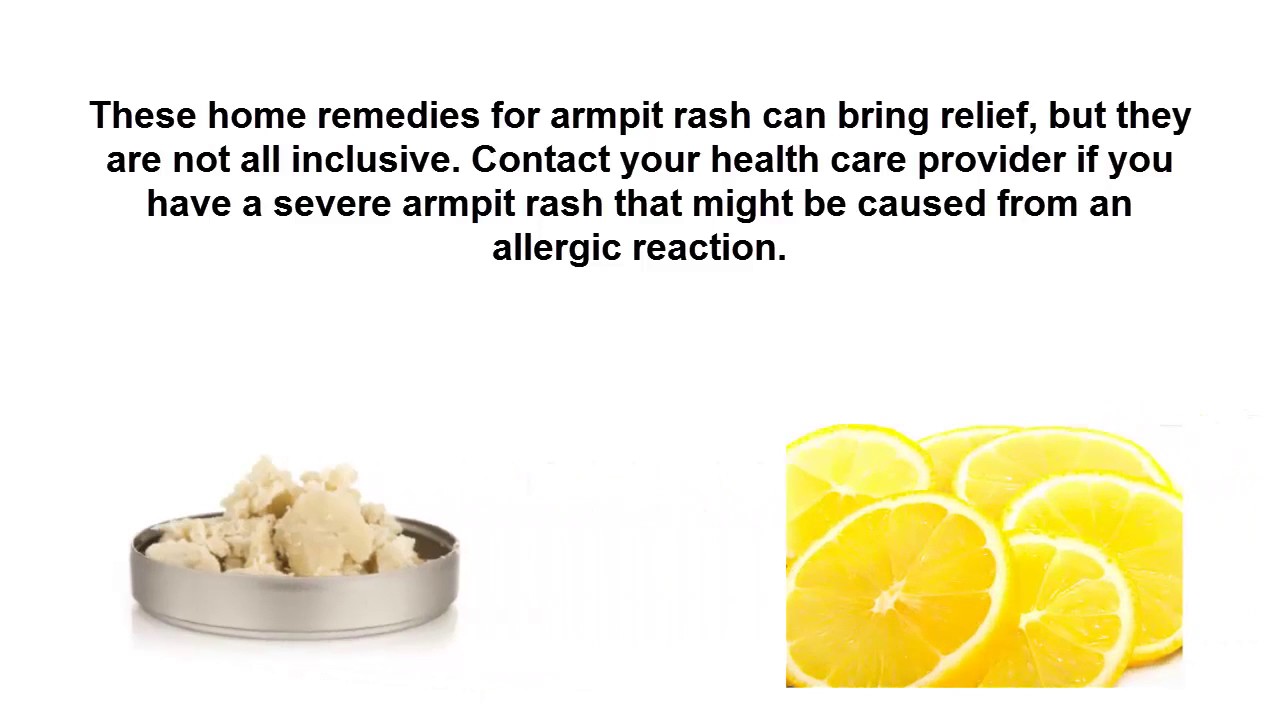 Home Remedy For Itchy Underarm Rash Bruin Blog