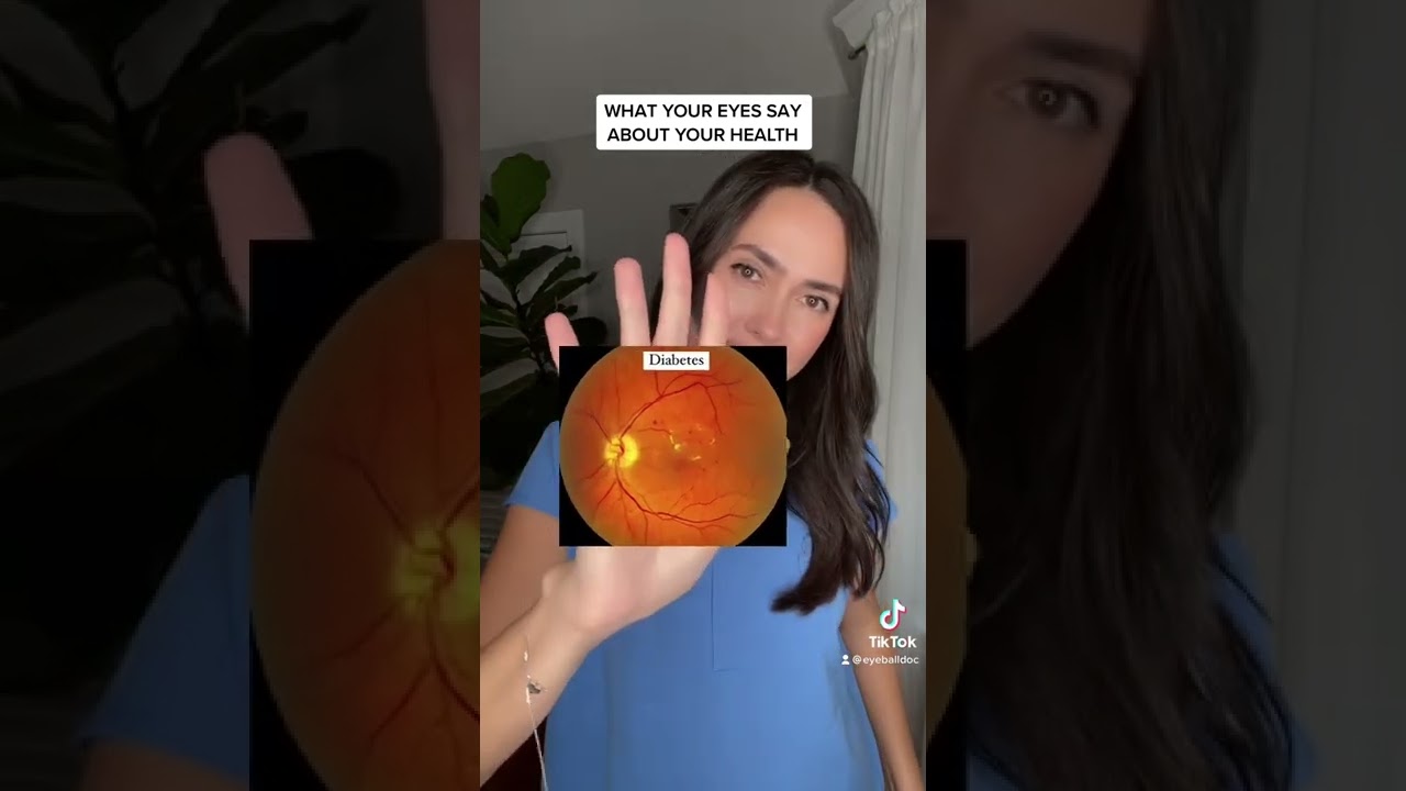 What your eyes say about your health 