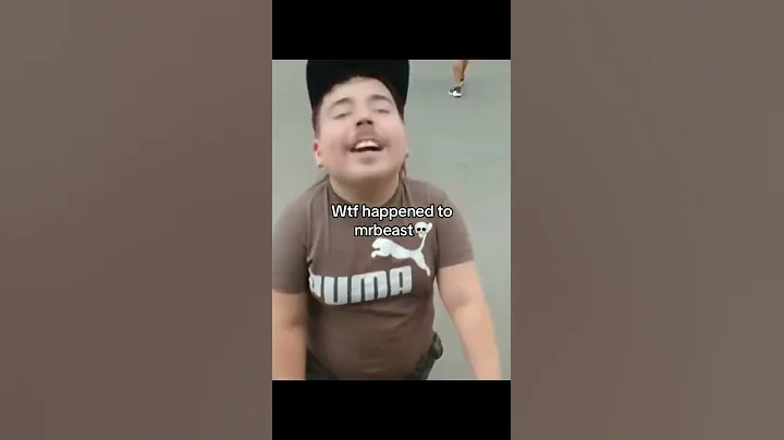 what happened to mr beast Bro😭 #mrbeast #fyp #foryou #xyzbca #foryoupage #fypシ #viral