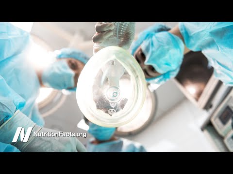 Vídeo: Què vol dir ondulació als implants mamaris?