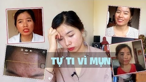 TỰ TI vì MỤN | Làm sao để hết tự ti & mặc cảm khi bị mụn? Tâm sự cùng mặt mụn ep.4