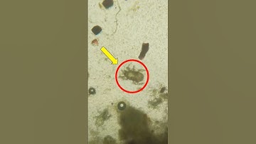 Look at maggi under microscope #shorts #ytshorts