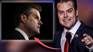 Famous Plastic Surgeon Reveals What Happened to Matt Gaetz’s Face Net Worth