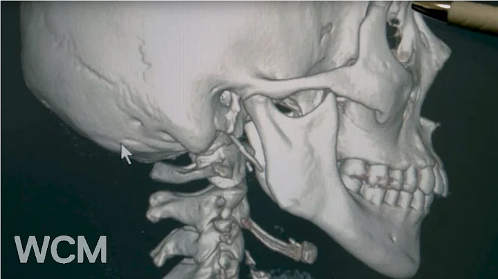 Facial Reconstruction | Dr. Anthony Sclafani | Wei...