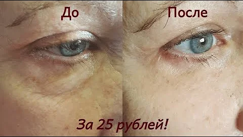 Недорогое аптечное средство для омоложения кожи лица. Бюджетная альтернатива дорогому крему!