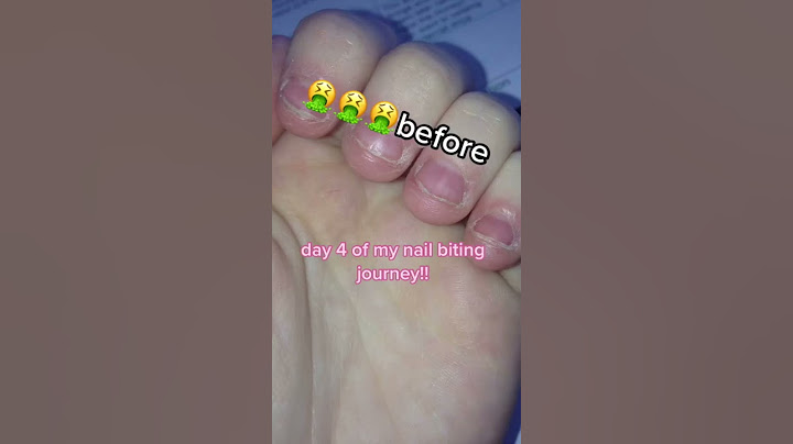 NAIL BITING JOURNEY        #day4,