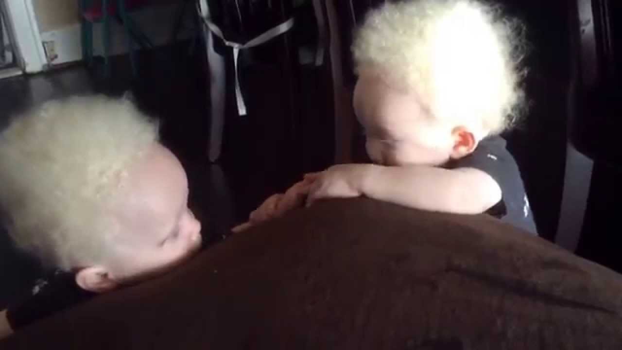 Albino Twins