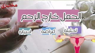 اختبار حمل إيجابى ولست حامل,أسبابه و طرق إكتشافه الطبية الصحيحة | د/ ريهام الشال